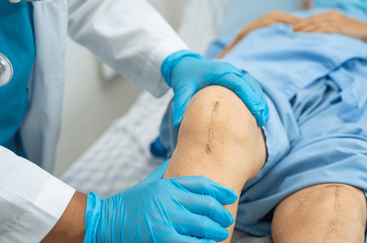 Joint Replacement Surgery